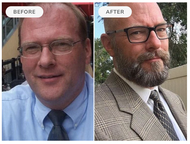 Before and after — 90 days of Beard Boost