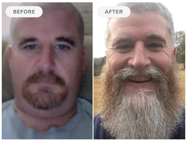Before and after — 90 days of Beard Boost