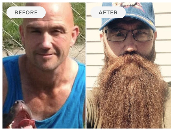 Before and after — 90 days of Beard Boost